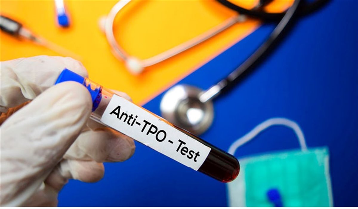 آزمایش Anti TPO چیست؟