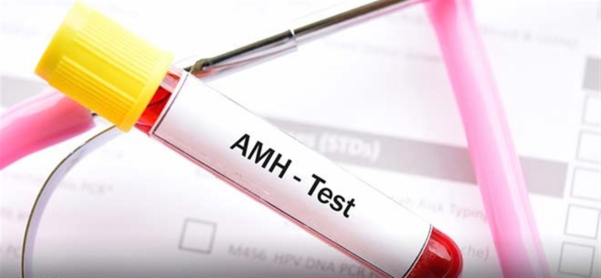 آزمایش AMH 