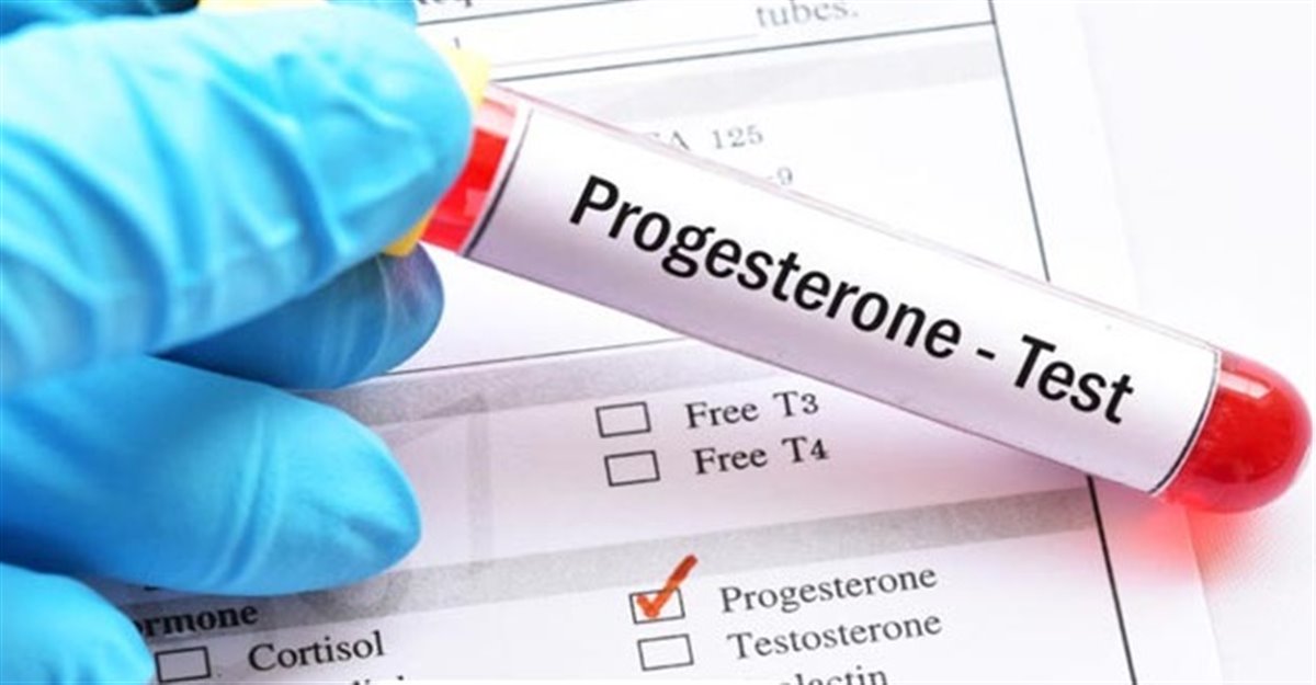 آزمایش  progesterone   