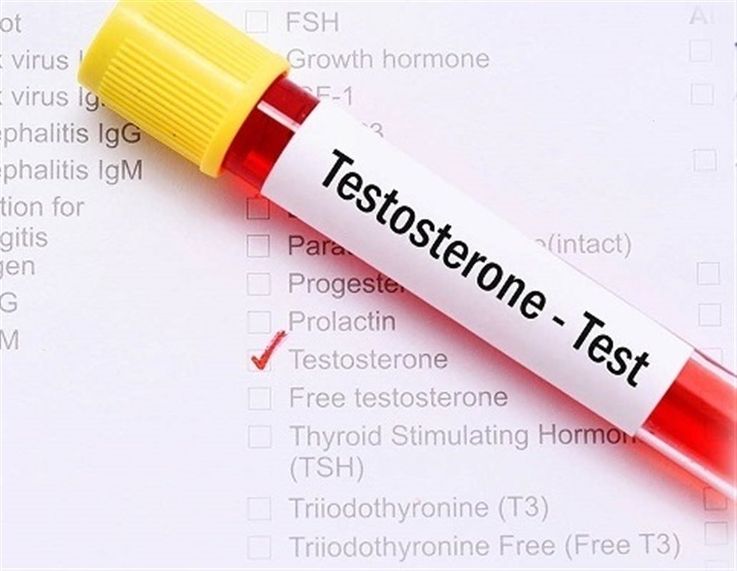 آزمایش testosterone