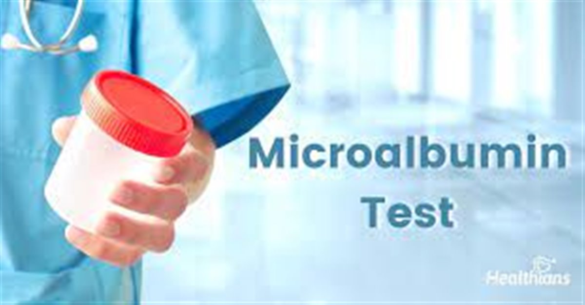لزوم آزمایش میکروآلبومین در افراد دیابتیک